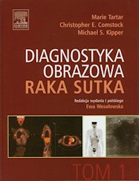 Diagnostyka obrazowa raka sutka Tom 1 - Tartar Marie, Comstock Christopher E., Kipper Michael S. - książka