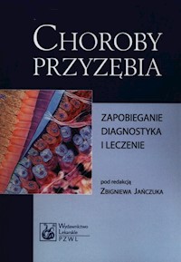 Choroby przyzębia -  - książka