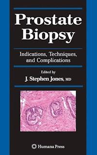Prostate Biopsy - - ebook