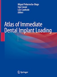 Atlas of Immediate Dental Implant Loading -  - ebook