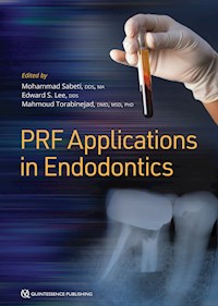 PRF Applications in Endodontics - Mohammad Sabeti - ebook