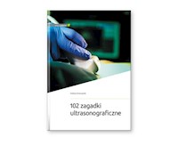 102 zagadki ultrasonograficzne - Smereczyński Andrzej - książka