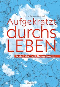Aufgekratzt durchs Leben. Mein Leben mit Neurodermitis - Lisa Reiser-Wötzel - ebook