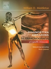Ultrasonografia przypadki kliniczne - Middleton William D. - książka
