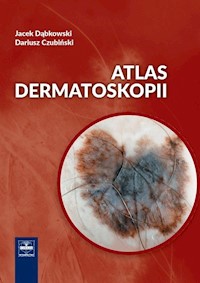 Atlas dermatoskopii - Dąbkowski Jacek, Czubiński Dariusz - książka