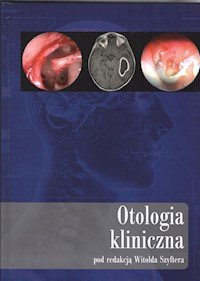 Otologia kliniczna - - książka