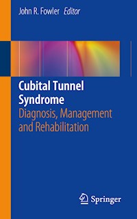 Cubital Tunnel Syndrome -  - ebook