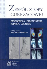 Zespół stopy cukrzycowej. Patogeneza, diagnostyka, klinika, leczenie - Waldemar Karnafel (red.) - książka