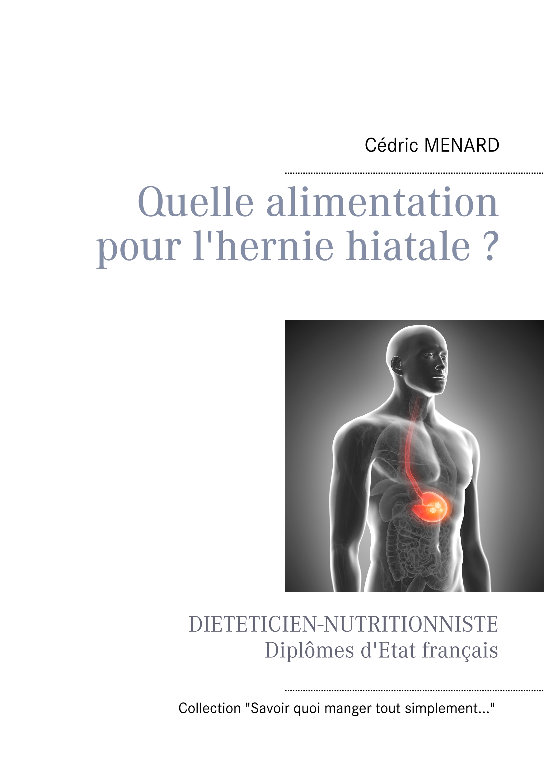 Quelle alimentation pour l'hernie hiatale ? - Menard Cédric - ebook