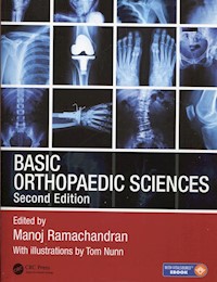Basic Orthopaedic Sciences - Ramachandran Manoj - książka