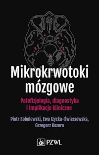 Mikrokrwotoki mózgowe - Sobolewski Piotr, Iżycka-Świeszewska Ewa, Kozera Grzegorz - książka