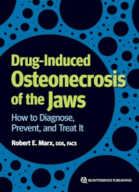 Drug-Induced Osteonecrosis of the Jaws - Robert E. Marx - ebook