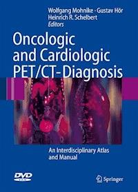 Oncologic and Cardiologic PET/CT-Diagnosis - - ebook