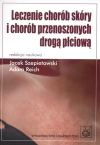 Leczenie chorób skóry i chorób przenoszonych drogą płciową - Szepietowski Jacek, Reich Adam - książka