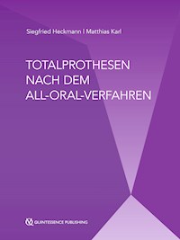 Totalprothesen nach dem All-Oral-Verfahren - Siegfried Heckmann - ebook