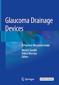 Glaucoma Drainage Devices -  - ebook