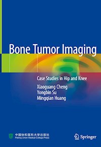 Bone Tumor Imaging - Xiaoguang Cheng - ebook
