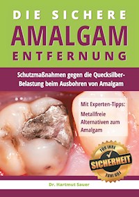 Die sichere Amalgam-Entfernung - Hartmut Sauer - ebook